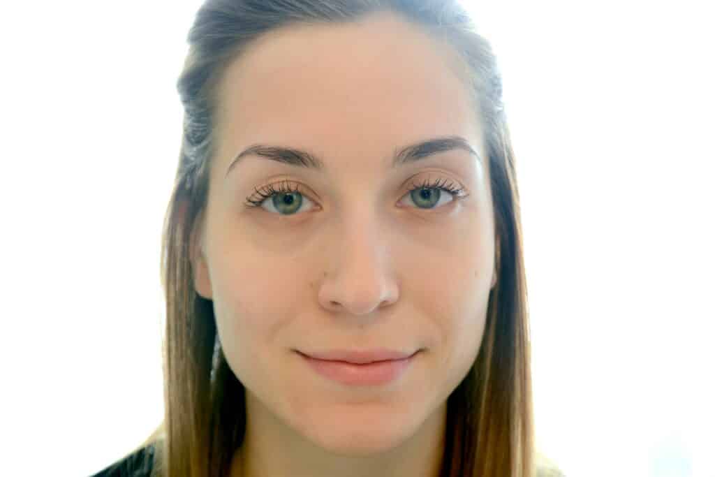 Müde Augen, Ade! - Die Thalgo Hyaluron Augenpads 5 veralice thalgo augenpads nachher1